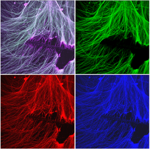 Cultured sensory neurons were injured and stained with acetylated tubulin (green), alpha tubulin (red) and GAP43 (blue). Tubulin deacetylation occurs at the site of injury, a process required for axon regeneration.