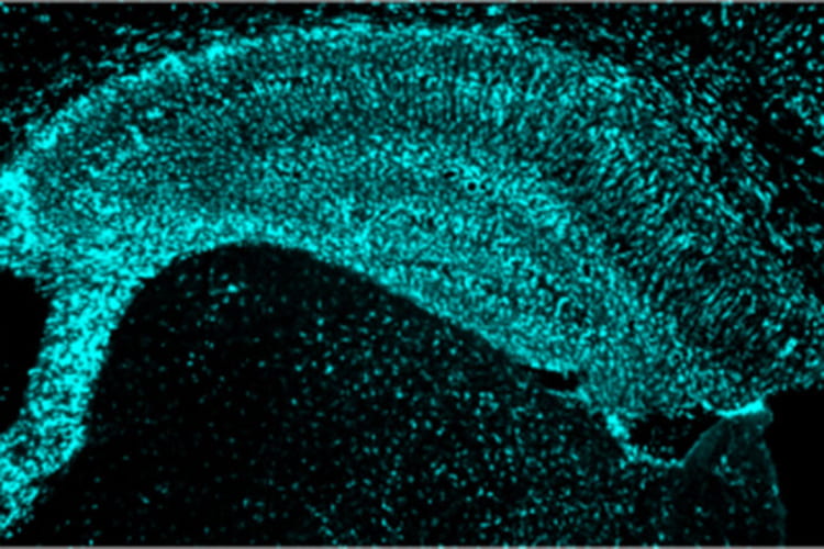 Mice prone to developing Alzheimer’s-like brain damage have potentially damaging activated immune cells in their brains (above). Researchers at Washington University School of Medicine in St. Louis have found that high levels of a normal protein associated with reduced heart disease also protect against Alzheimer’s-like damage in mice, opening up new approaches to slowing or stopping brain damage and cognitive decline in people with Alzheimer’s. (Image: Yang Shi)